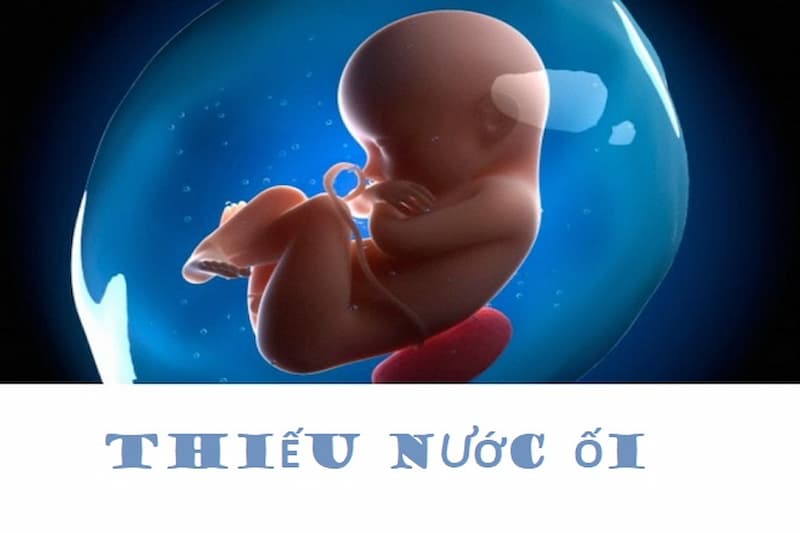 Nguyên nhân gây ra tình trạng ít nước ối là gì?